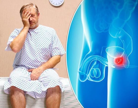 Síntomas de prostatitis