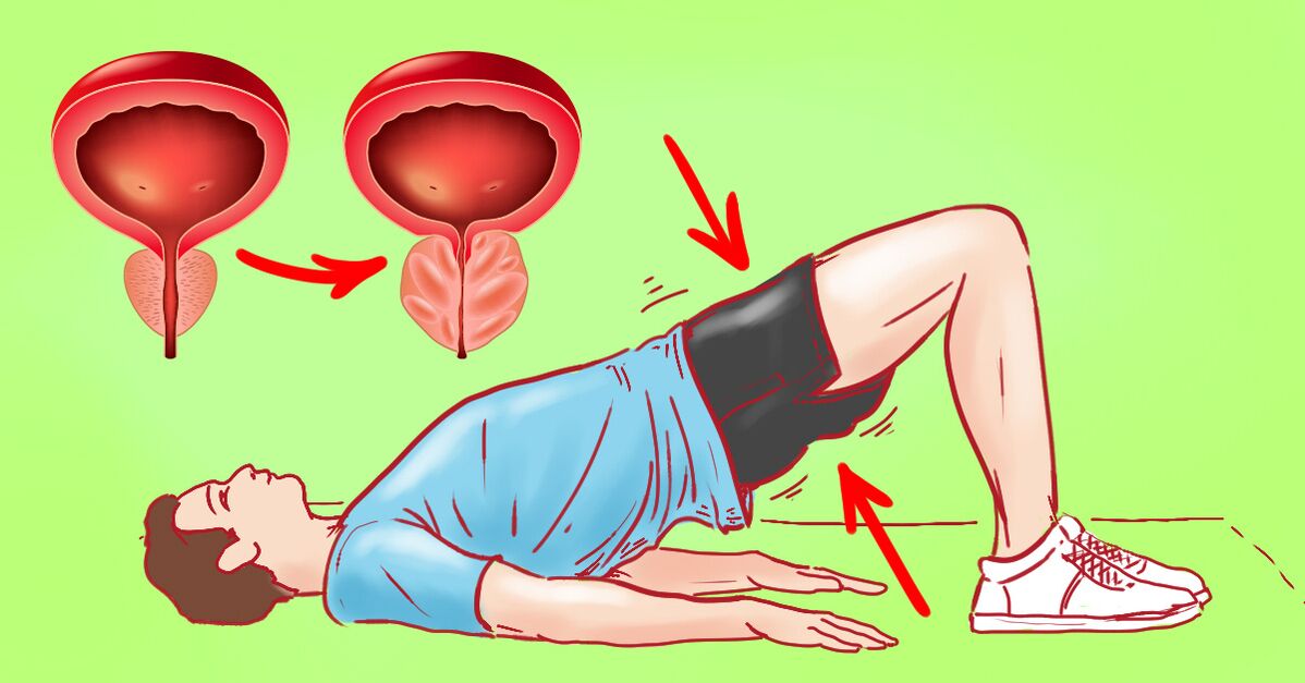ejercicios de gimnasia para la prostatitis